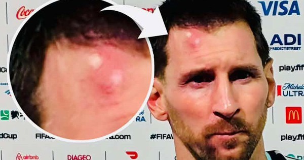 GO88 uy tín đồng hành cùng fan bóng đá sau pha chấn thương nhẹ của Messi - hình ảnh - go88bet.vip GO88 uy tín đồng hành cùng fan bóng đá sau pha chấn thương nhẹ của Messi - hình ảnh - go88bet.vip